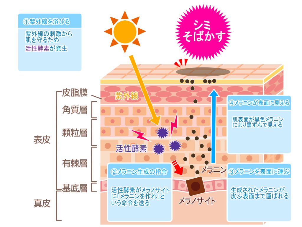 医師が教える シミってなに 六本木の美容医療 美容皮膚科はthe Roppongi Clinic