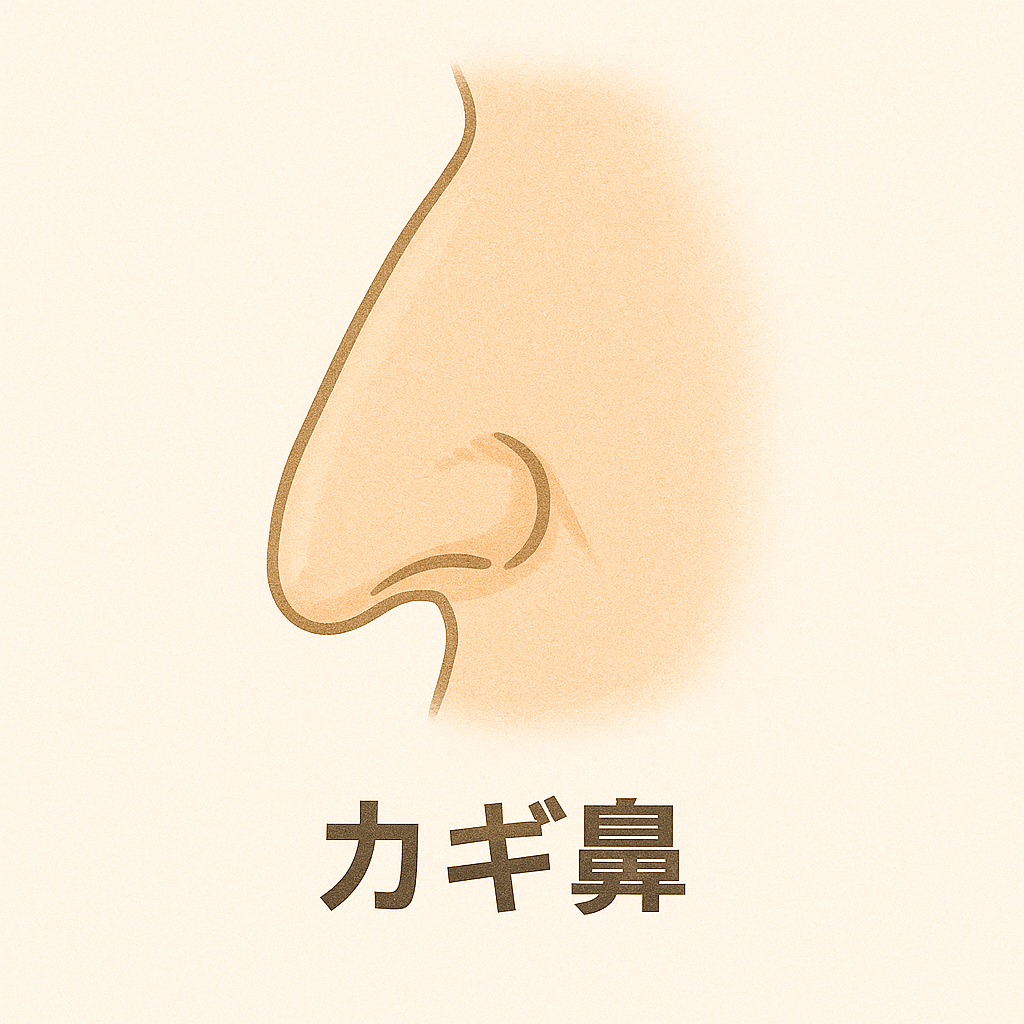 カギ鼻