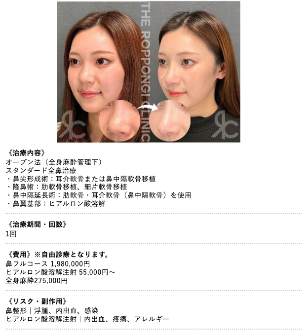 鼻フルコース　オープン法
