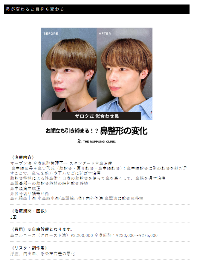 鼻骨骨切り幅寄せ術