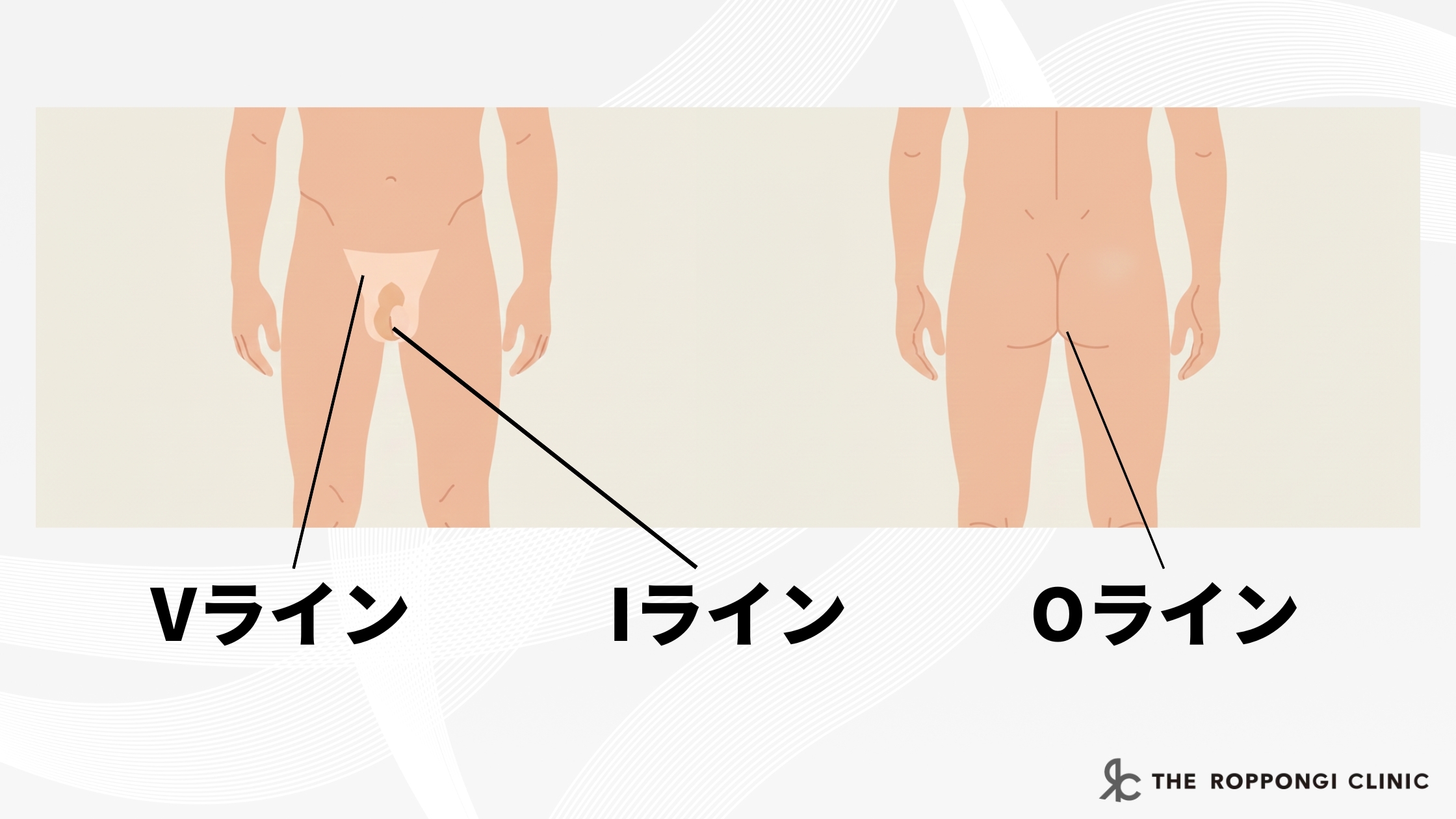 メンズVIOのイラスト