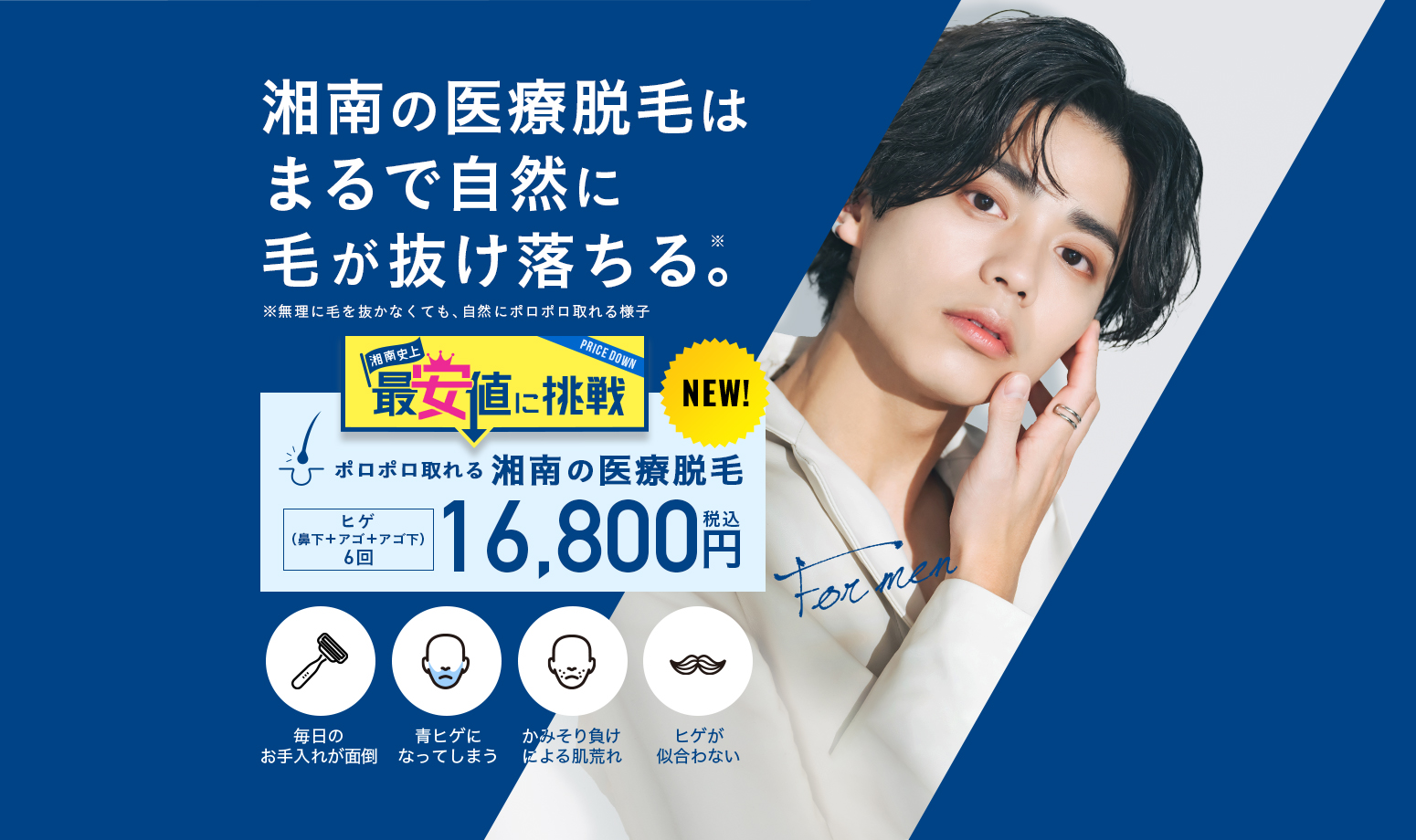 湘南美容クリニックのメンズ医療脱毛