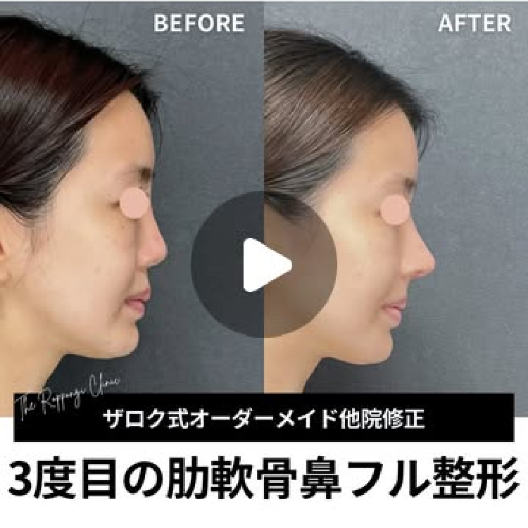 症例写真9