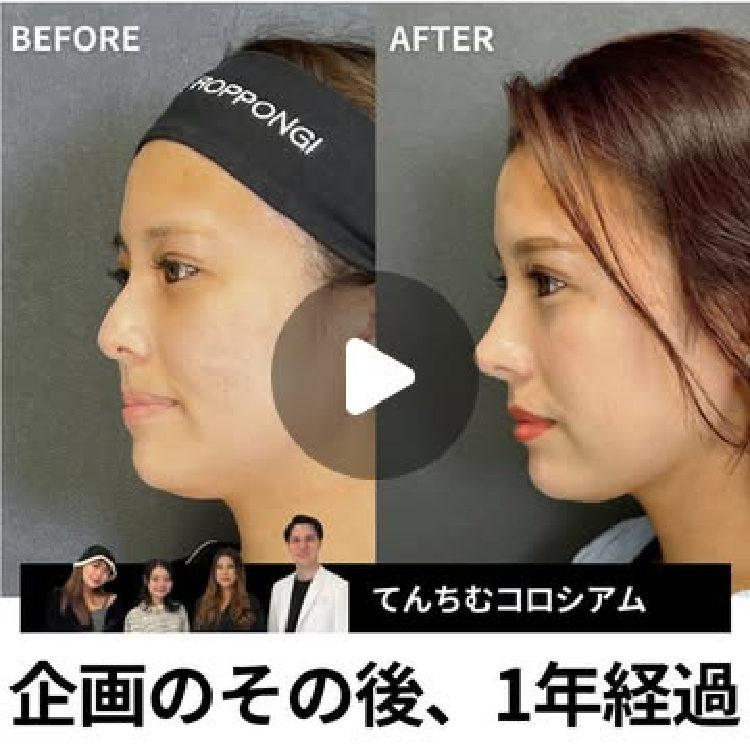 症例写真10