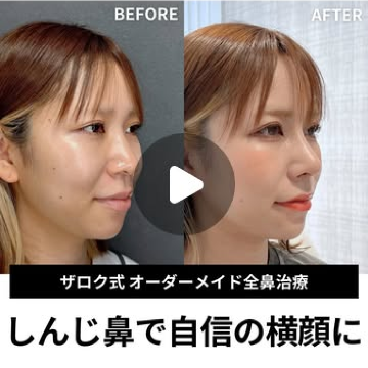 症例写真12