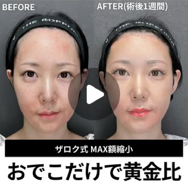 症例写真13