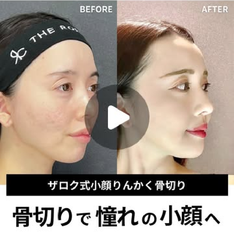 症例写真14