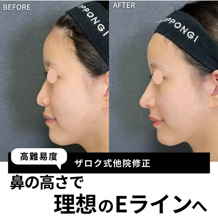 症例写真15