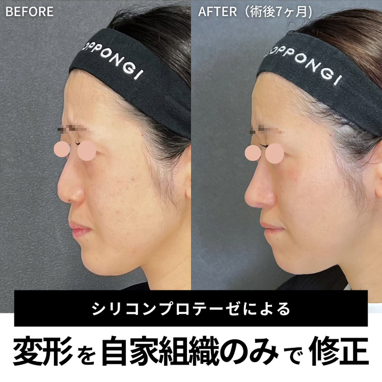症例写真16