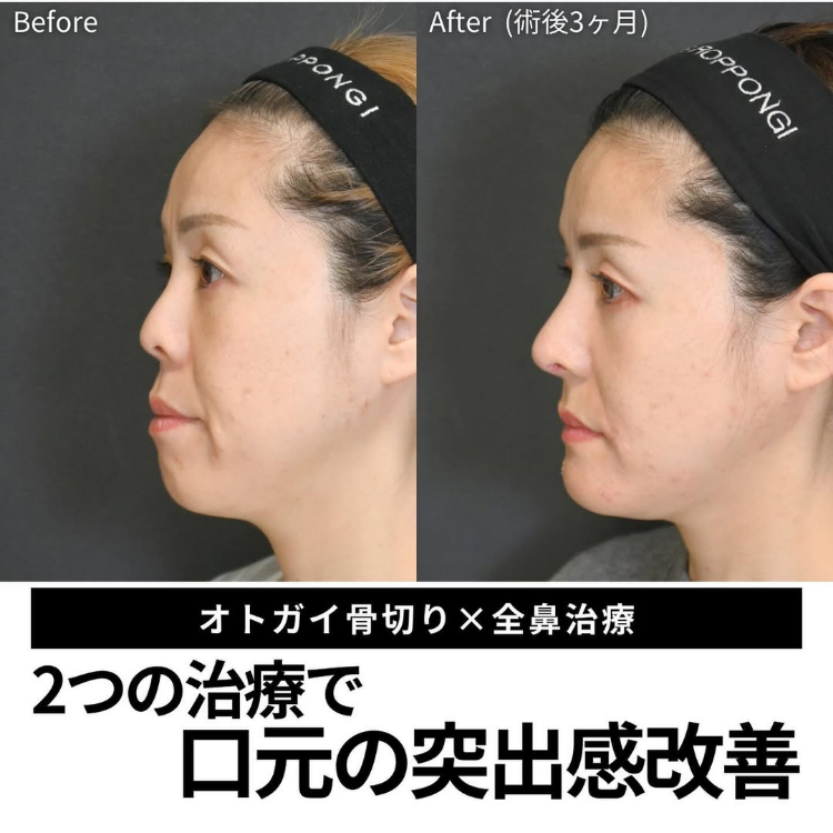 症例写真17