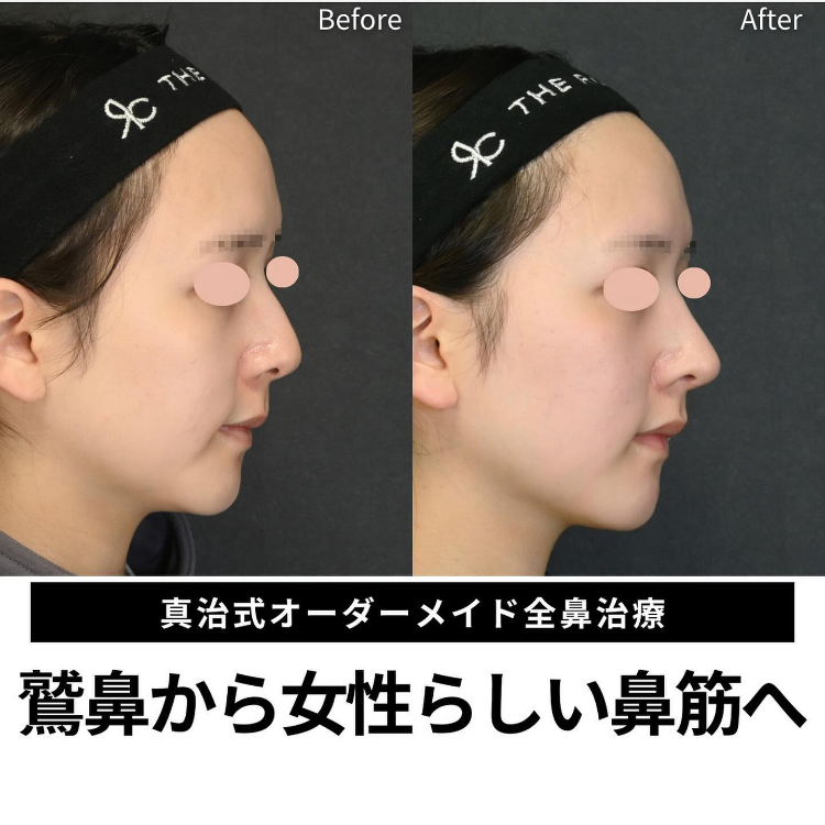 症例写真18