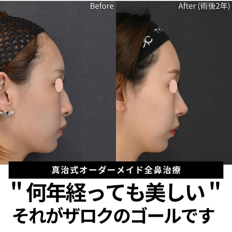 症例写真19