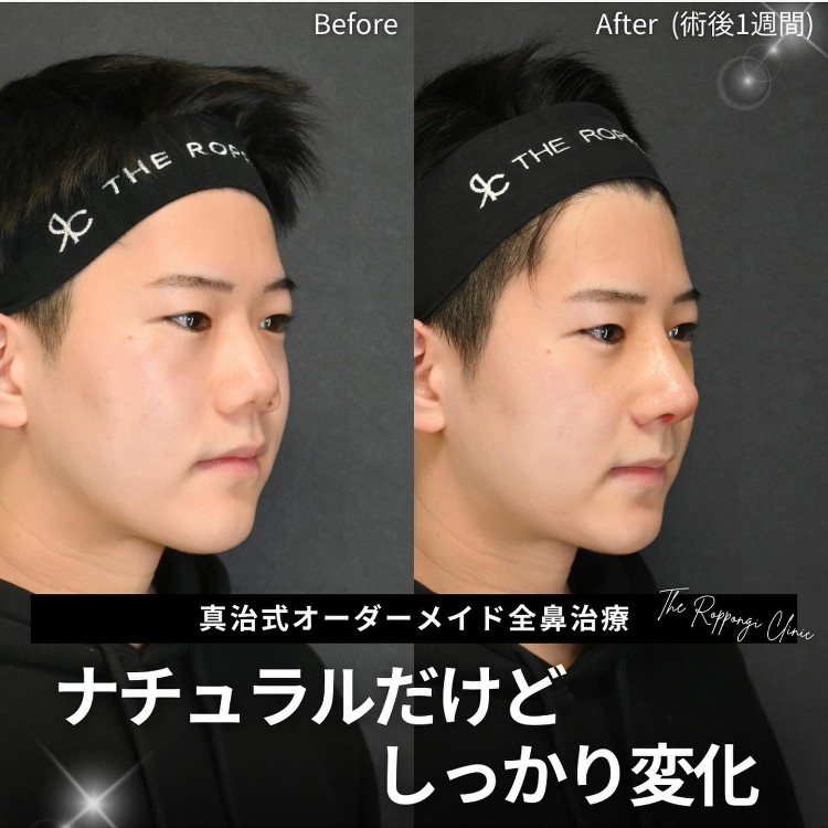 症例写真20