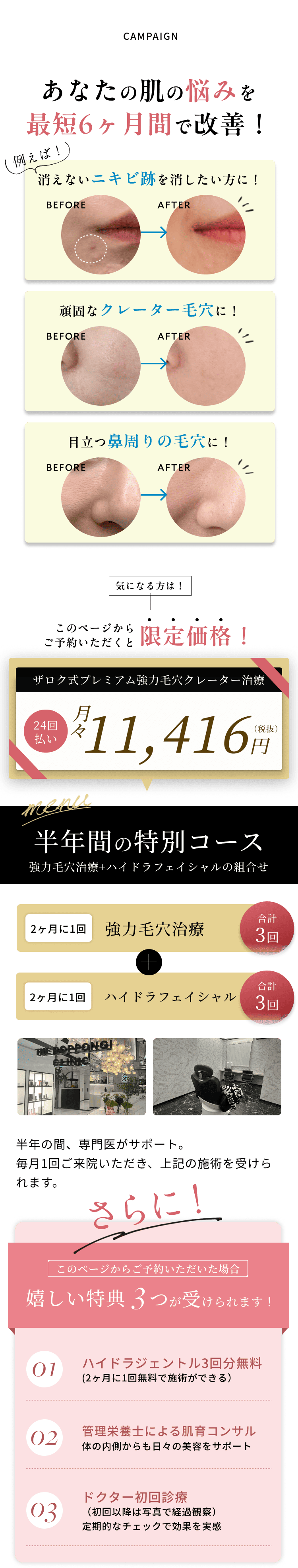 あなたの肌の悩みを最短6ヶ月間で改善