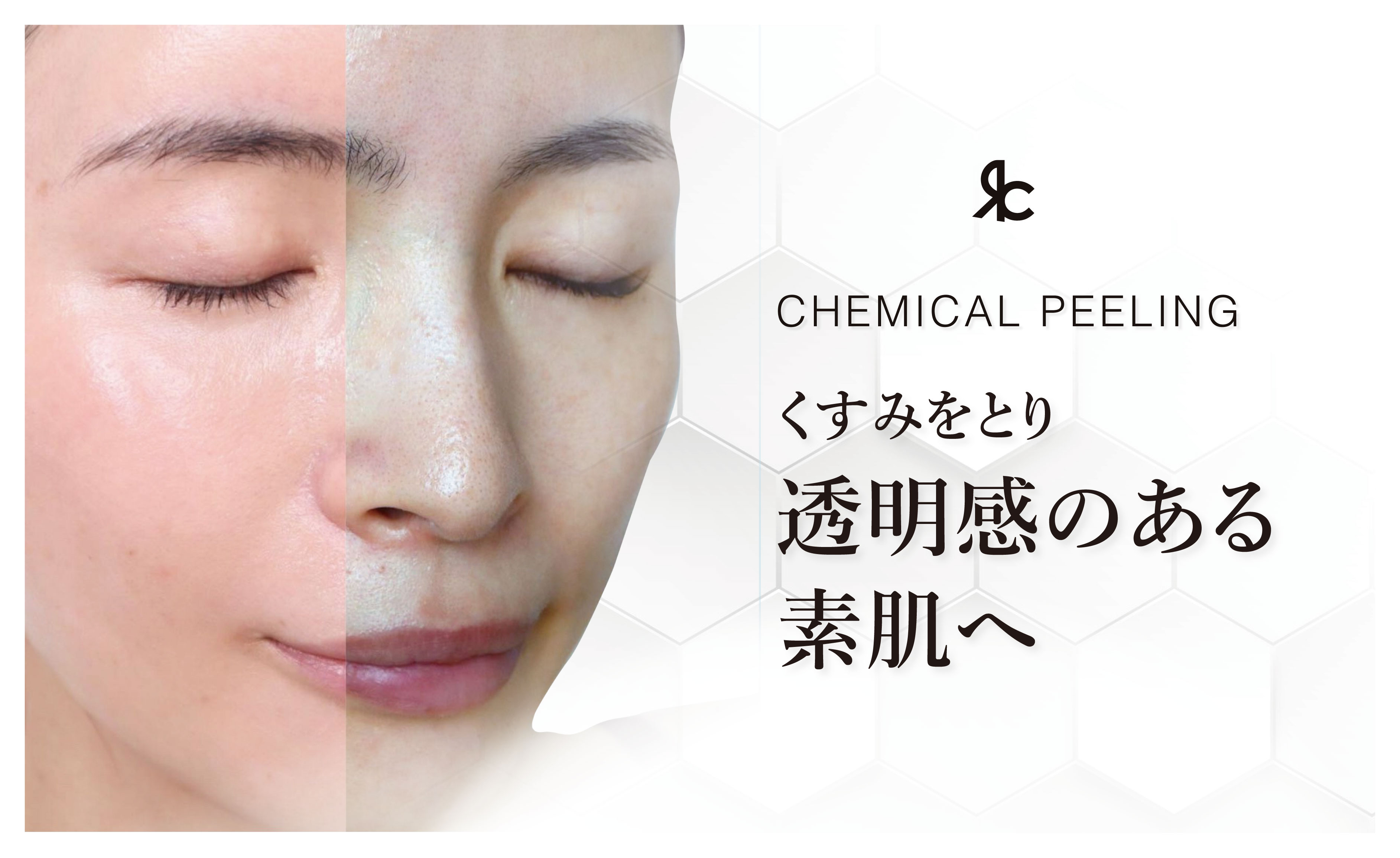 ケミカルピーリング：新しい皮膚の再生を促す
