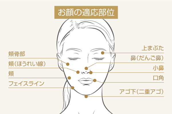 脂肪溶解注射：お顔の適用部位