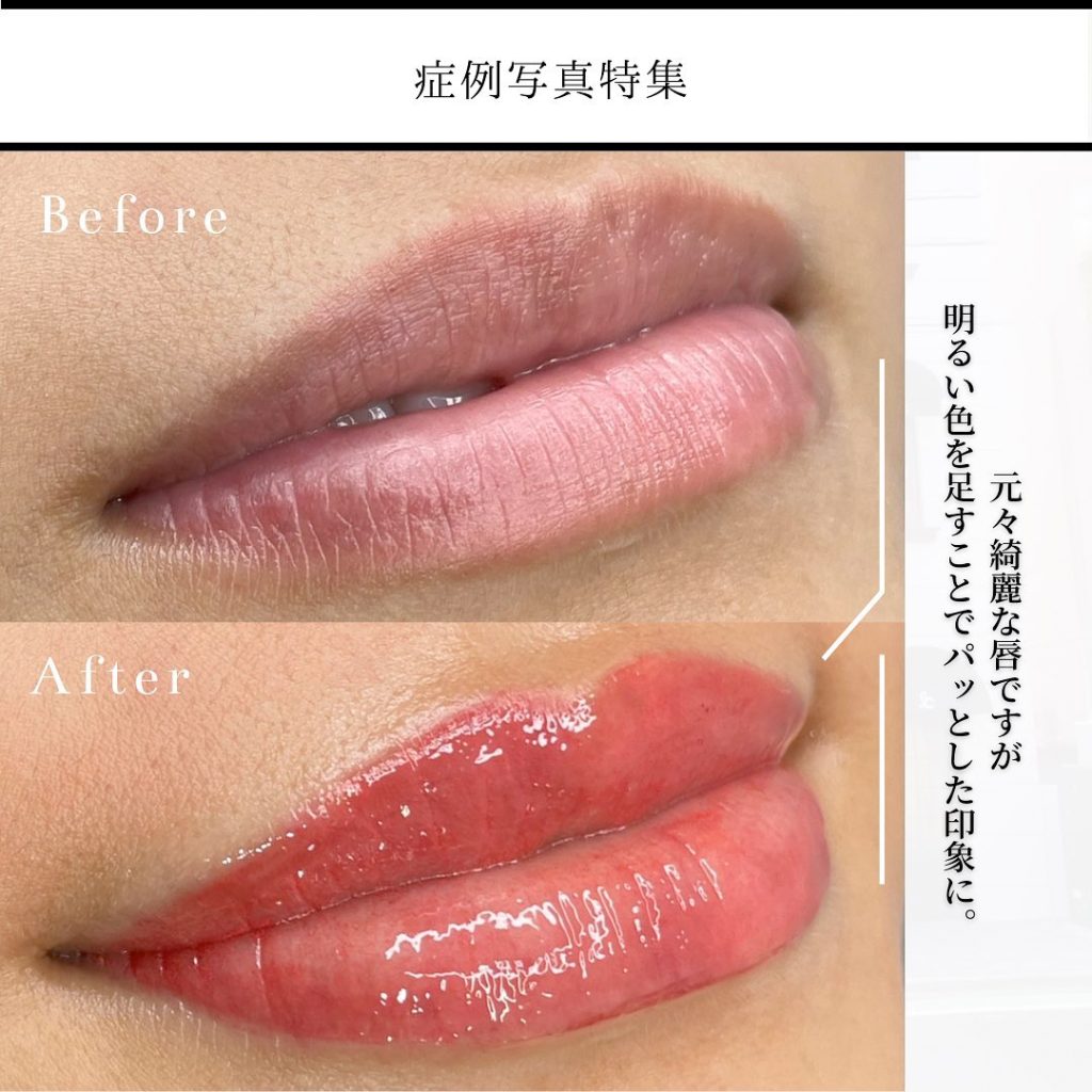 唇アートメイク
