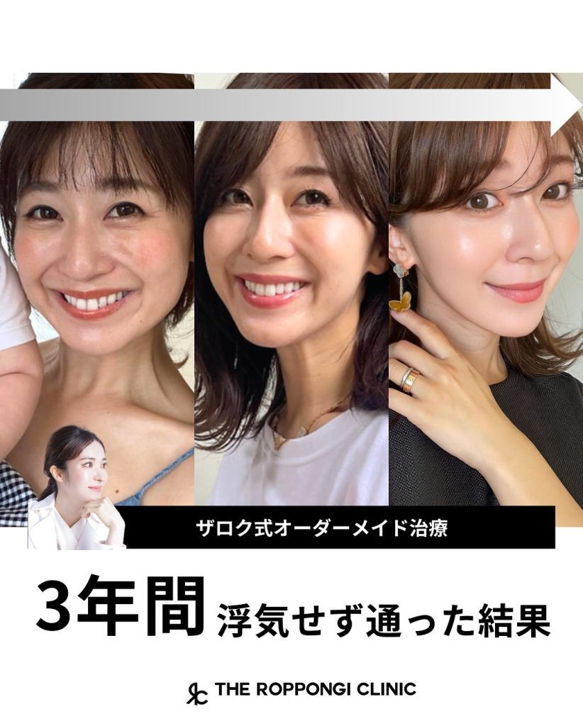 3年間通って下さった結果