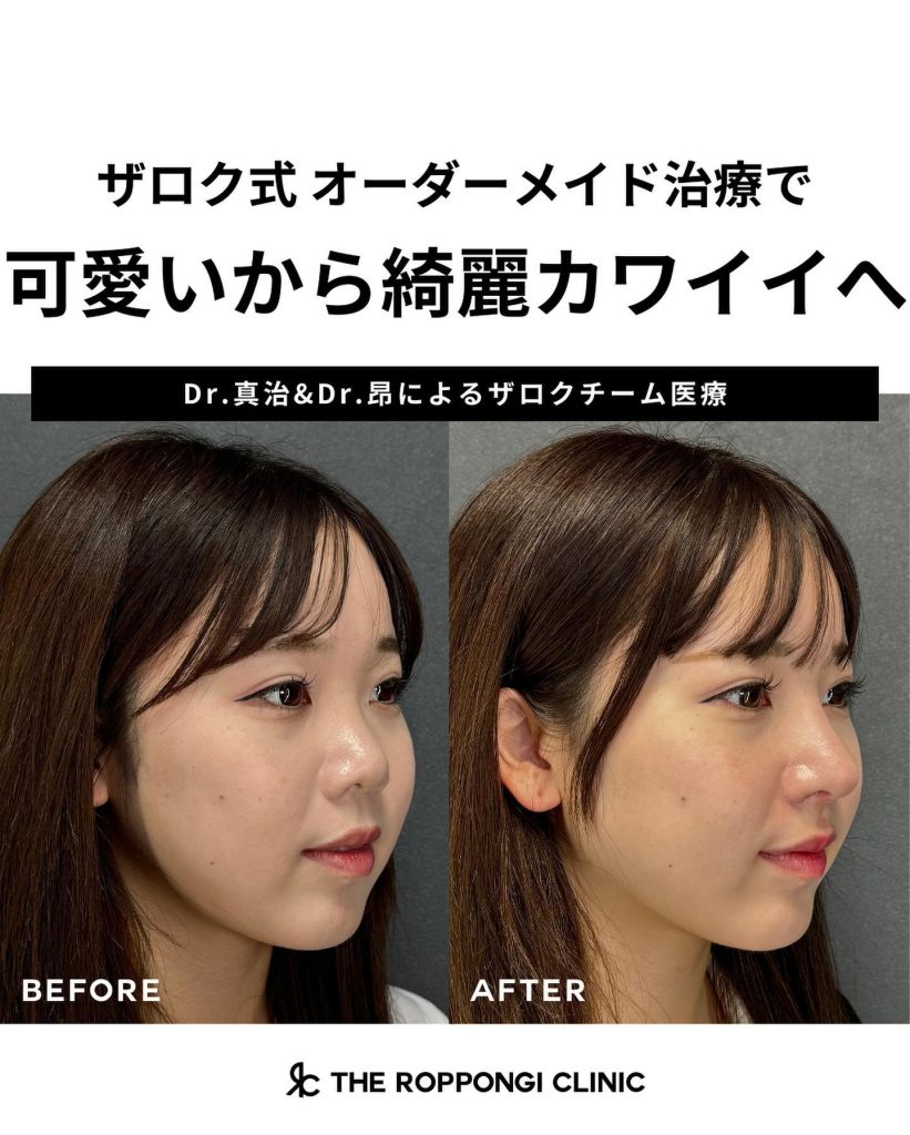 鼻だけで可愛いから綺麗カワイイへ