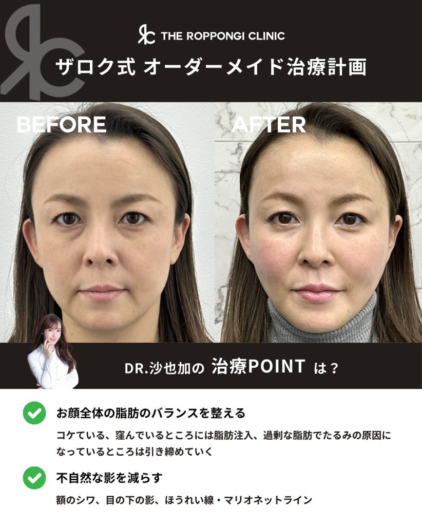 口横のもたつきが気になる…