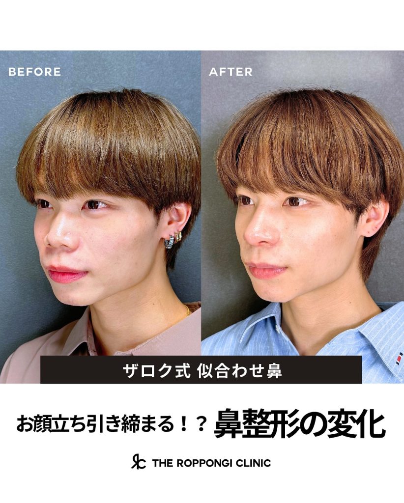 鼻が変わると自身も変わる！