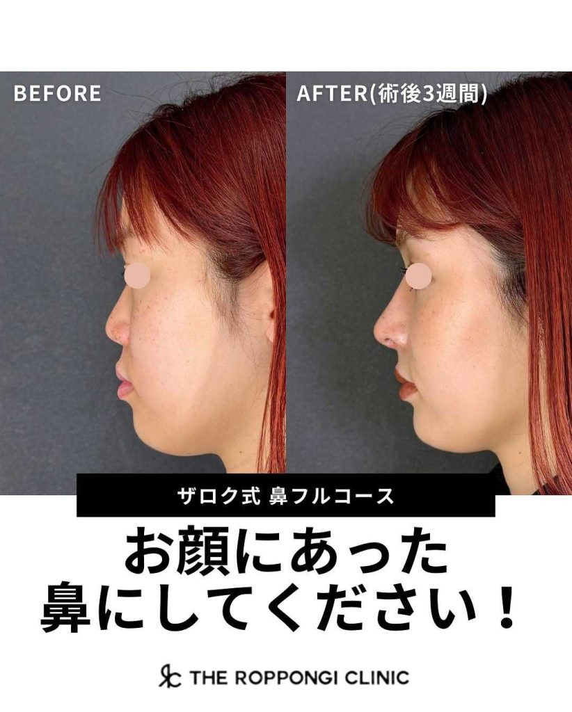 お顔にあった鼻にしてください！