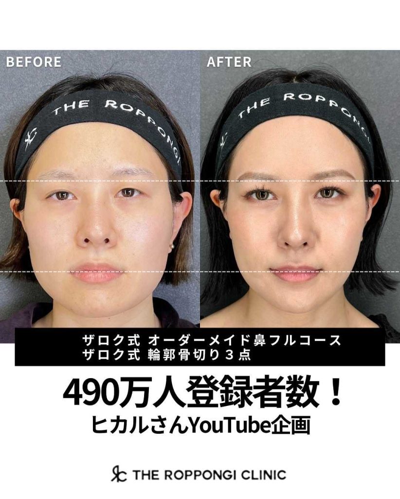 ヒカルさんYouTube企画で大変身