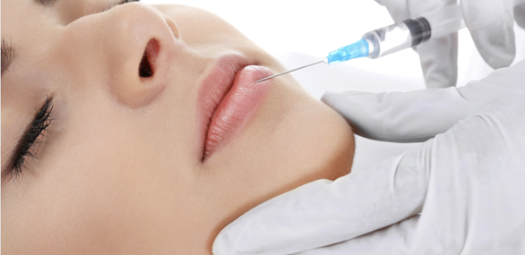 唇ヒアルロン酸