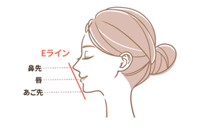 顎ヒアルロン酸