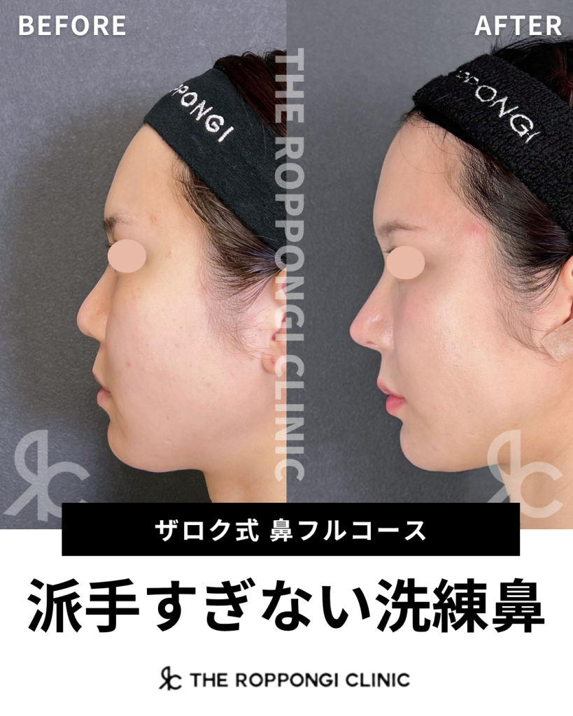 鼻フルで派手すぎない洗練鼻に