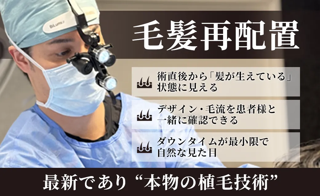 毛髪再配置・植毛