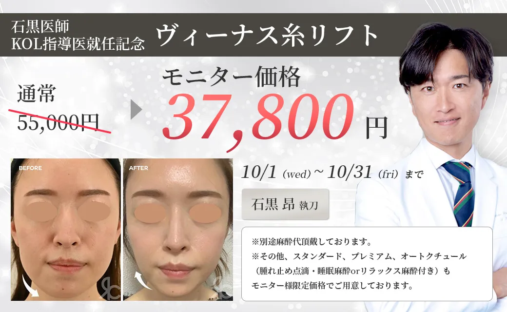 ヴィーナス糸リフト