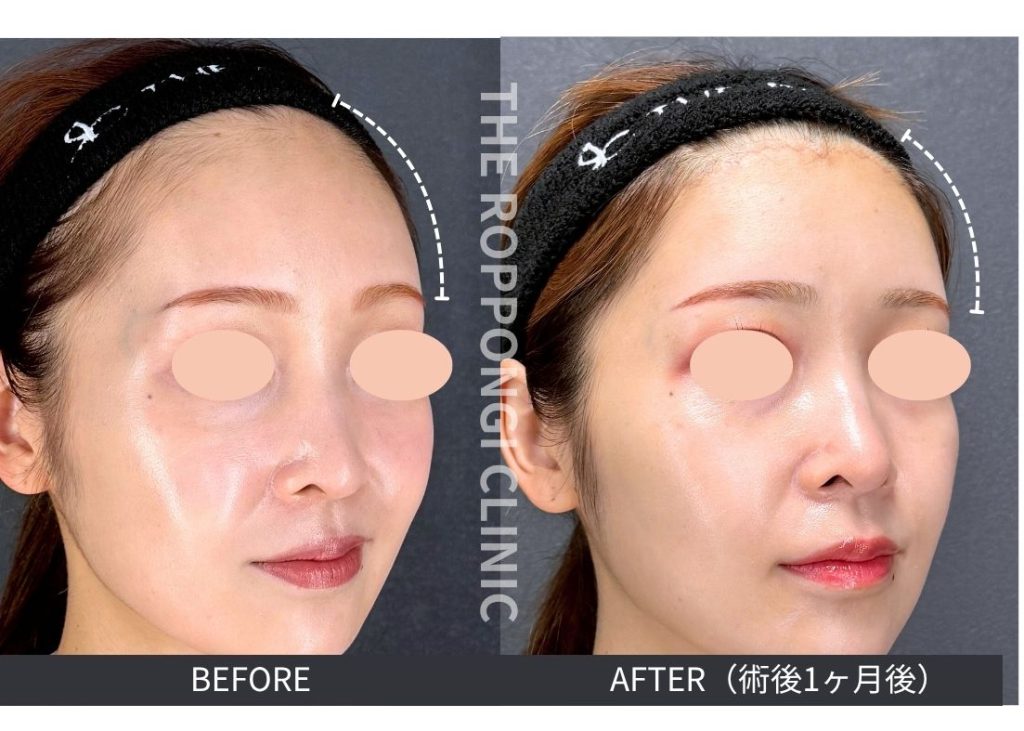 お顔の余白が無くなる