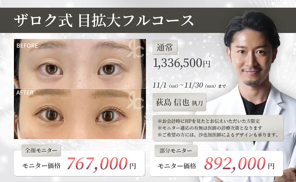 ザロク式 目拡大フルコース