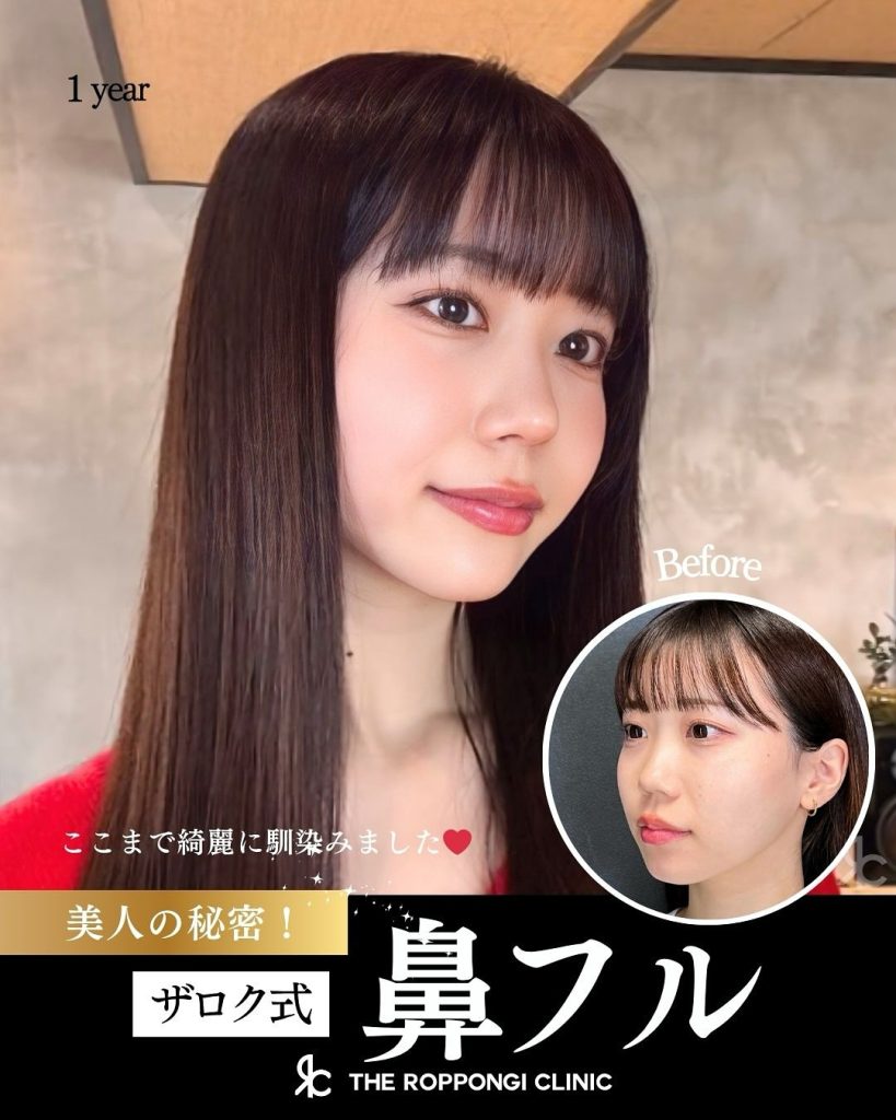 美人の秘密・ザロク式鼻フル