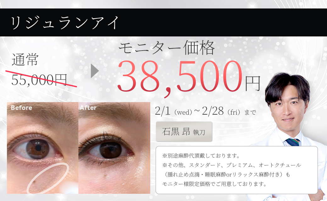 リジュランアイ モニター募集