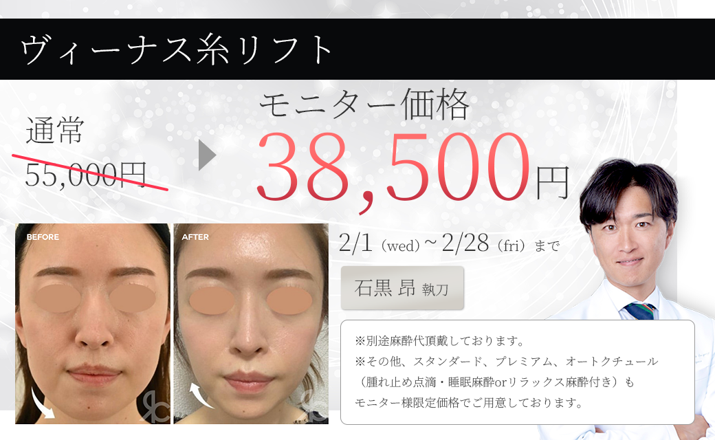 ヴィーナスリフト　モニター募集