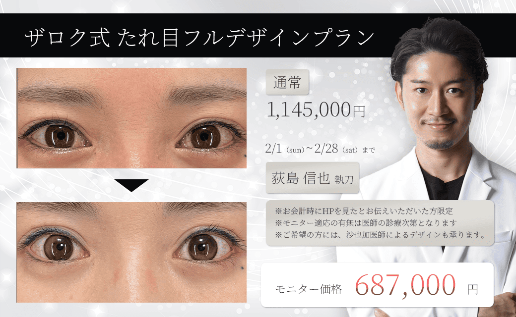 傷ザロク式たれ目フルデザインプラン モニター募集