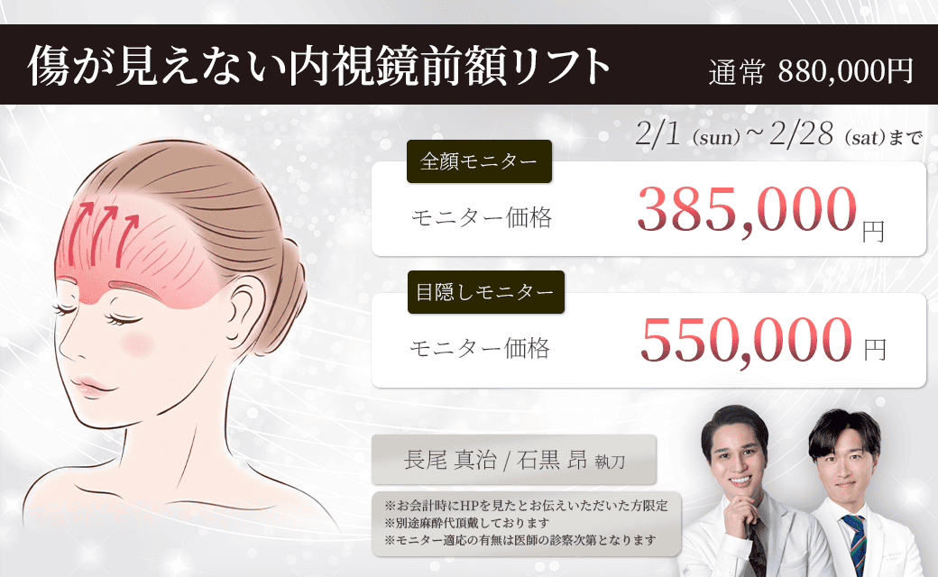 傷が見えない 内視鏡前額リフト モニター募集