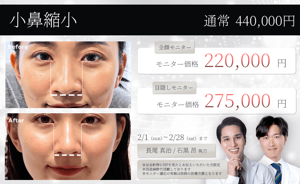 小鼻縮小　モニター募集