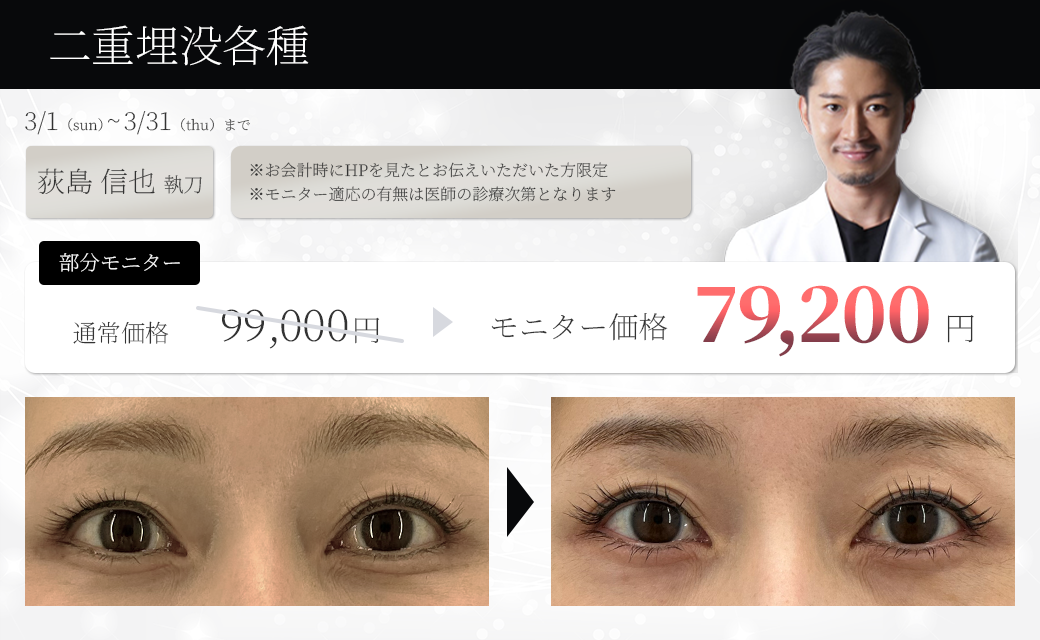 二重埋没各種モニター募集